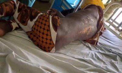 Islamic cleric and 60 others, beat 14-year-old boy to comma in Kwara