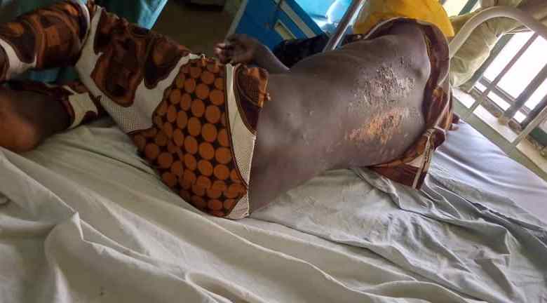 Islamic cleric and 60 others, beat 14-year-old boy to comma in Kwara