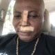 70-Year-Old Charly Boy Sustains Facial Injuries After Falling off Scooter