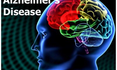 US release Alzheimer's drug