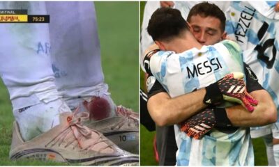 Argentina vs Colombia: Fans hails Messi's performance despite ankle injury