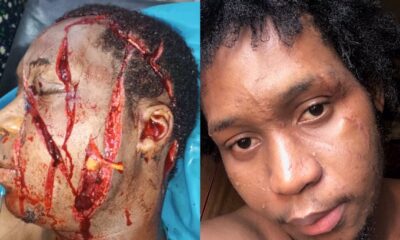 Upcoming Artist Narrates How He Survived a brutal Cultist Attack in Calabar.