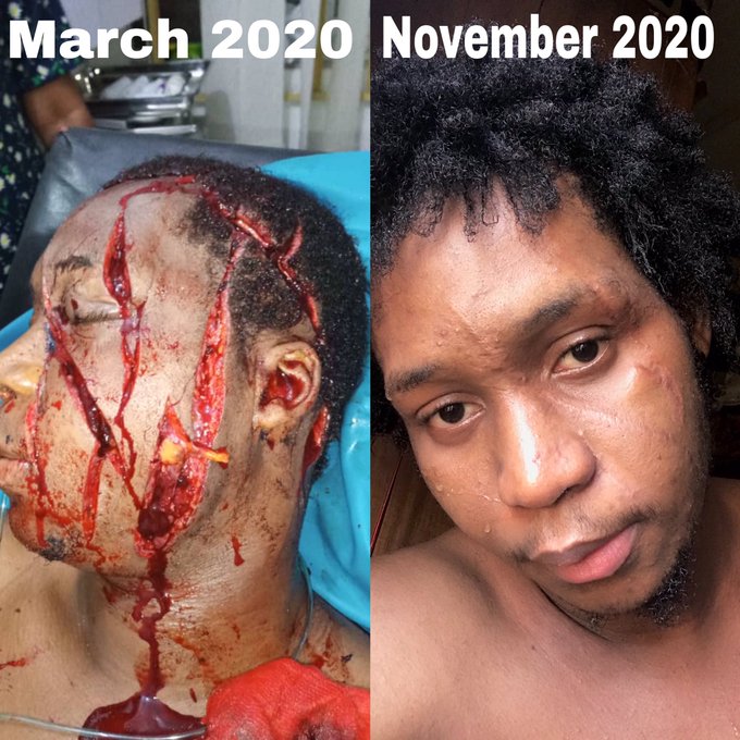 Upcoming Artist Narrates How He Survived a brutal Cultist Attack in Calabar.