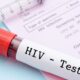 HIV Patient Cleared Of The Virus Without Any Antiviral Drugs - Report
