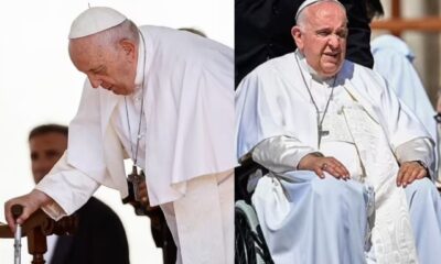 Pope Francis suffers stomach pain, to undergo surgery on his intestines