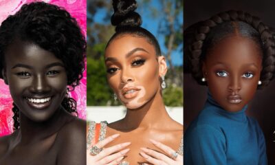 5 Rarest Black People In The World